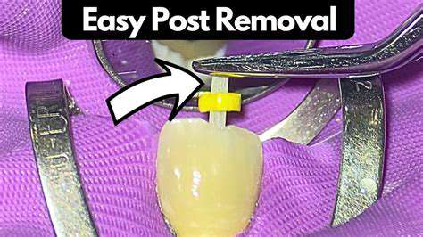 Fabric Cleaner: Upholstery Spot Cleaning